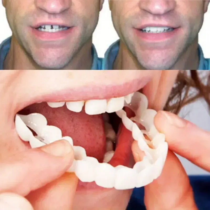 2 Pairs Snap-On Teeth Covers – Natural Look, Instant Smile Upgrade