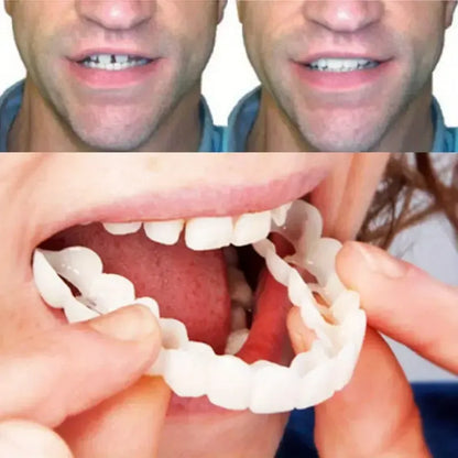2 Pairs Snap-On Teeth Covers – Natural Look, Instant Smile Upgrade