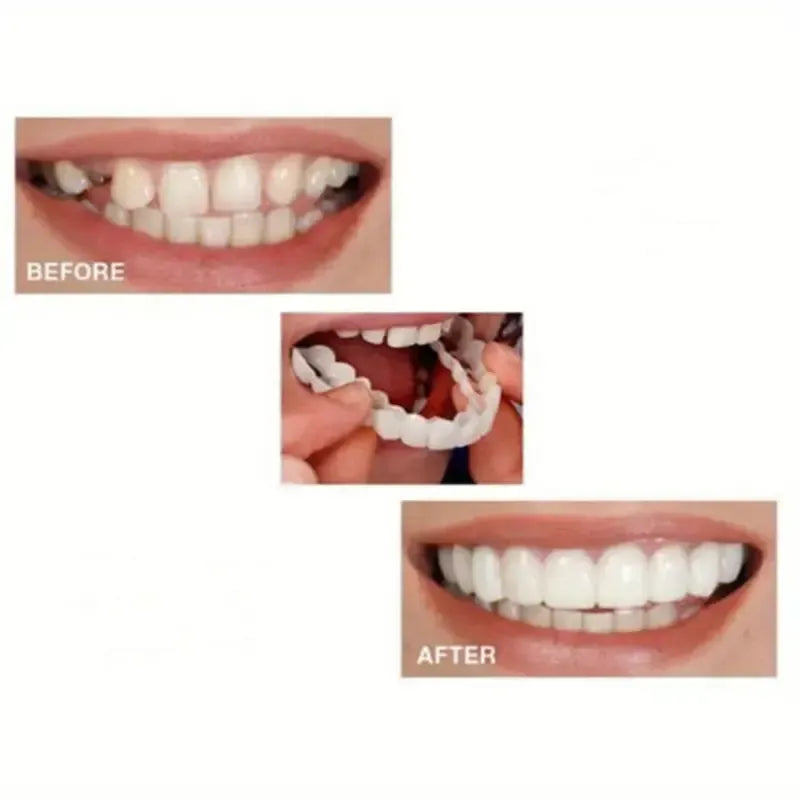 2 Pairs Snap-On Teeth Covers – Natural Look, Instant Smile Upgrade